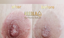 Перманентний камуфляж шкіри Мастер татуажа Марта Львов