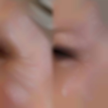 Навколо очей. Гусячі лапки