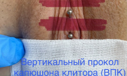 Интимный пирсинг женский Мастер по пирсингу Татьяна Киев