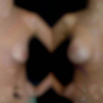 подтяжка груди