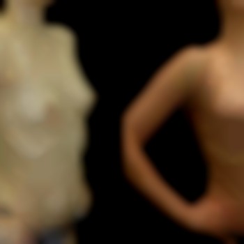 маммопластика