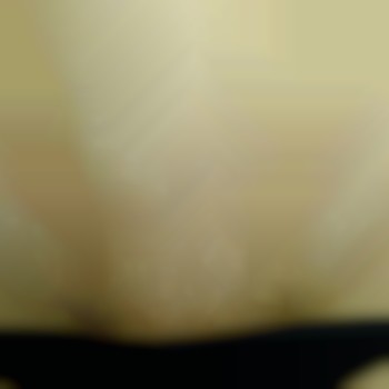  #Електроепіляція 
 #Электроэпиляция