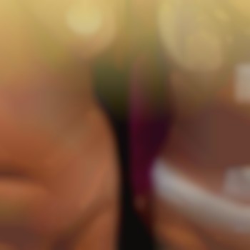 Абдоминопластика с укреплением мышц передней брюшной стенки