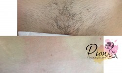 Бикини глубокое Преподаватель курсов красоты Алена Ирпень