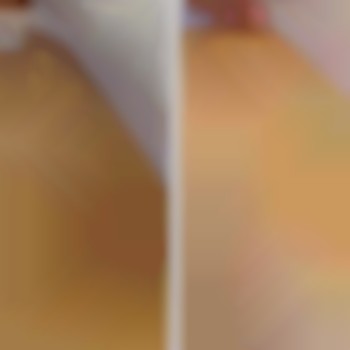 До и После, на втором фото 3-я процедура