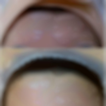 Супер лифт массаж