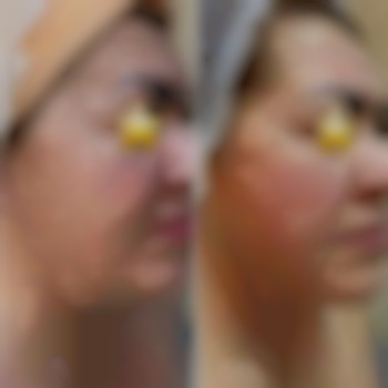 Супер лифт массаж