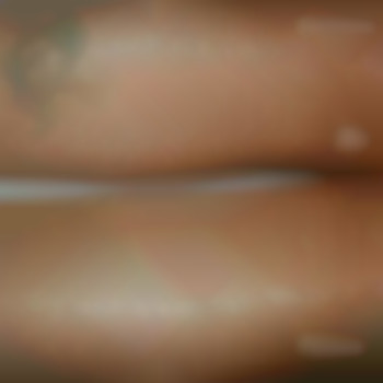 Шугаринг чоловічий
                    Массажист Катерина Днепр