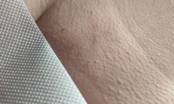 Депиляция бикини Мастер депиляции Валерия Киев