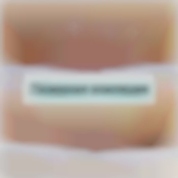 Лазерная эпиляция, фото - косметологический центр GENETIX