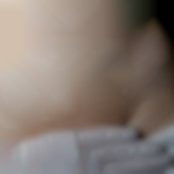 Таже девушка. Результат после 8ми процедур. Интервал между п