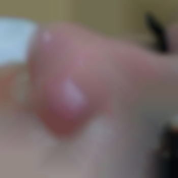 Чистка обличчя