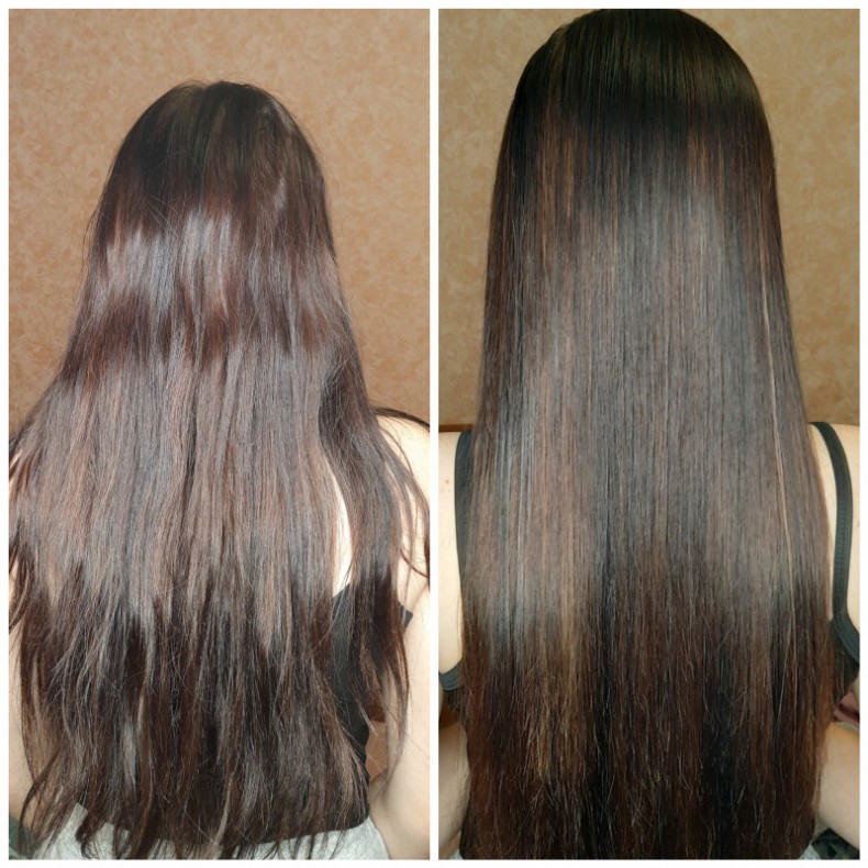 Биксипластия., фото - Парикмахер Яна Забуга