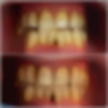 лікування пародонтиту в стоматології VA Clinic район Озерна.