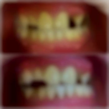 лікування пародонтиту Аліна Анатоліївна в стоматології VA Clinic район Озерна.