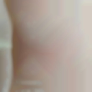 Лазерна епіляція на діодному лазері
                    Салон красоты Beauty Line Запорожье