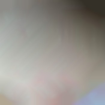 Зона ягодицы
Фотография сделана через неделю после процедур