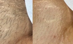 Шугаринг Мастер депиляции Ольга Агаджанова Одесса