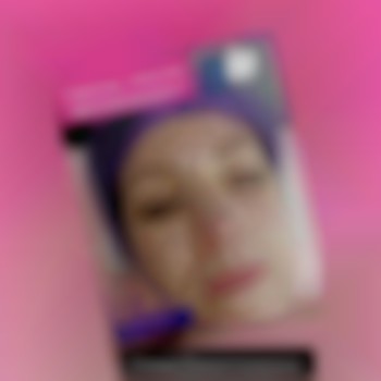 Инъекция мезотерапии,в данном случае использовалась папульна