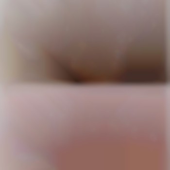 Бікіні До/Після