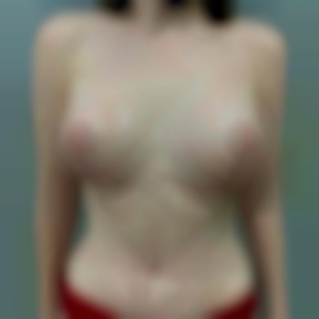 Абдоминопластика - от 2050€ все включено
                    Медичний центр Аура Київ