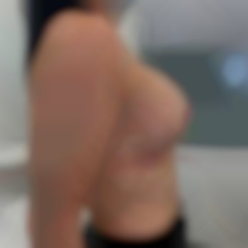 Увеличение груди от 2300€ все включено
                    Медичний центр Аура Київ