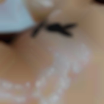  #депіляціяхарків