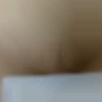 Бикини-результат после 7 процедуры