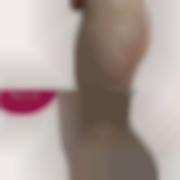 Абдоминопластика с липосакцией и липофилингом ягодиц