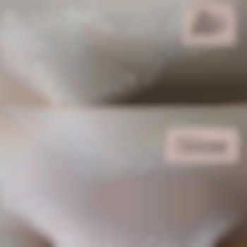 Шугаринг глибоке бікіні