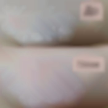 Шугаринг бікіні