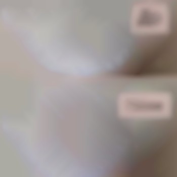 Шугаринг бікіні