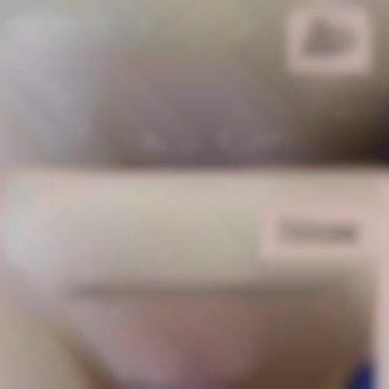 Шугаринг бікіні