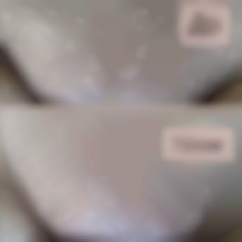 Шугаринг бікіні