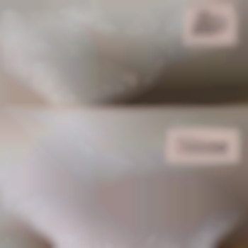 Шугаринг бікіні