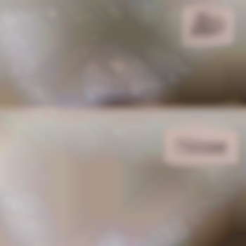 Шугаринг бікіні