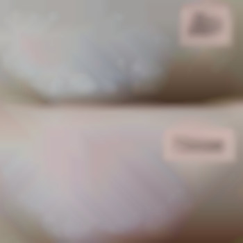 Шугаринг бікіні