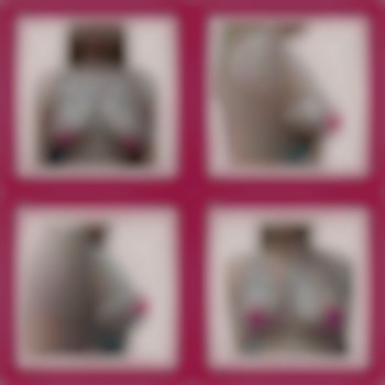 Редукция (уменьшение) груди с подтяжкой invert T