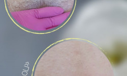 Восковая депиляция Масажист Ольга Дніпро