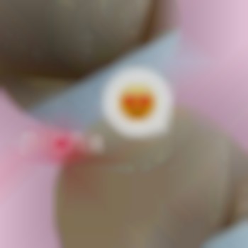 Лазерна епіляція