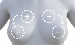 Заміна імплантів Медичний центр Alpha Cell Рівне