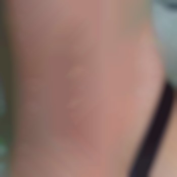 Электроэпиляция тело
                    Майстер депіляції Ирина Харків