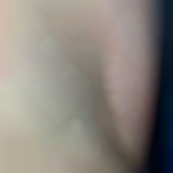 Электроэпиляция тело
                    Майстер депіляції Ирина Харків