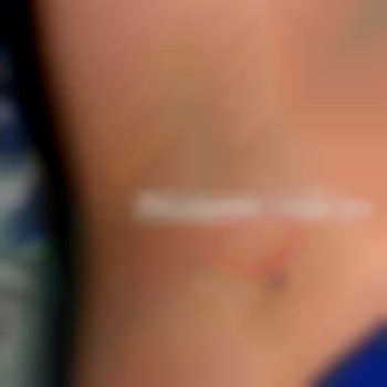 Электроэпиляция тело
                    Майстер депіляції Ирина Харків