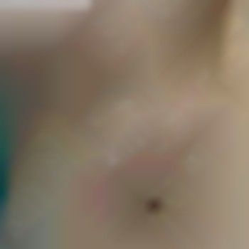 Электроэпиляция тело
                    Майстер депіляції Ирина Харків