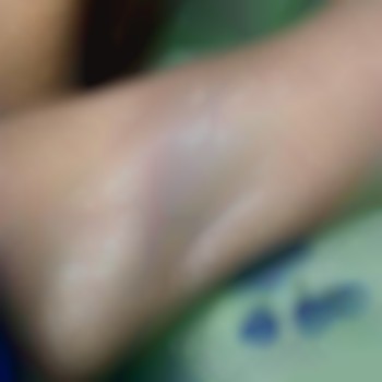 Электроэпиляция тело
                    Майстер депіляції Ирина Харків