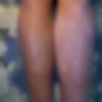 Электроэпиляция тело
                    Майстер депіляції Ирина Харків