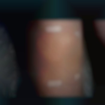 Электроэпиляция тело
                    Майстер депіляції Ирина Харків