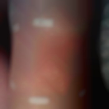 Электроэпиляция тело
                    Майстер депіляції Ирина Харків