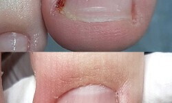 Подологічні послуги Подолог Тетяна Одеса